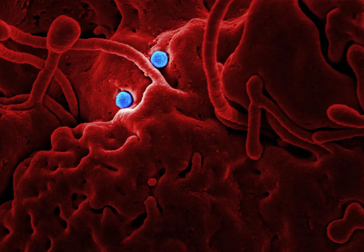 Ebola virus cell structure