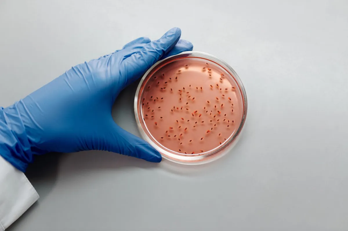 petri dish with bacterial growth