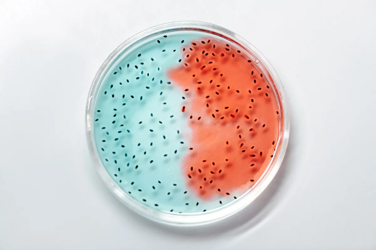 bacterial culture in lab