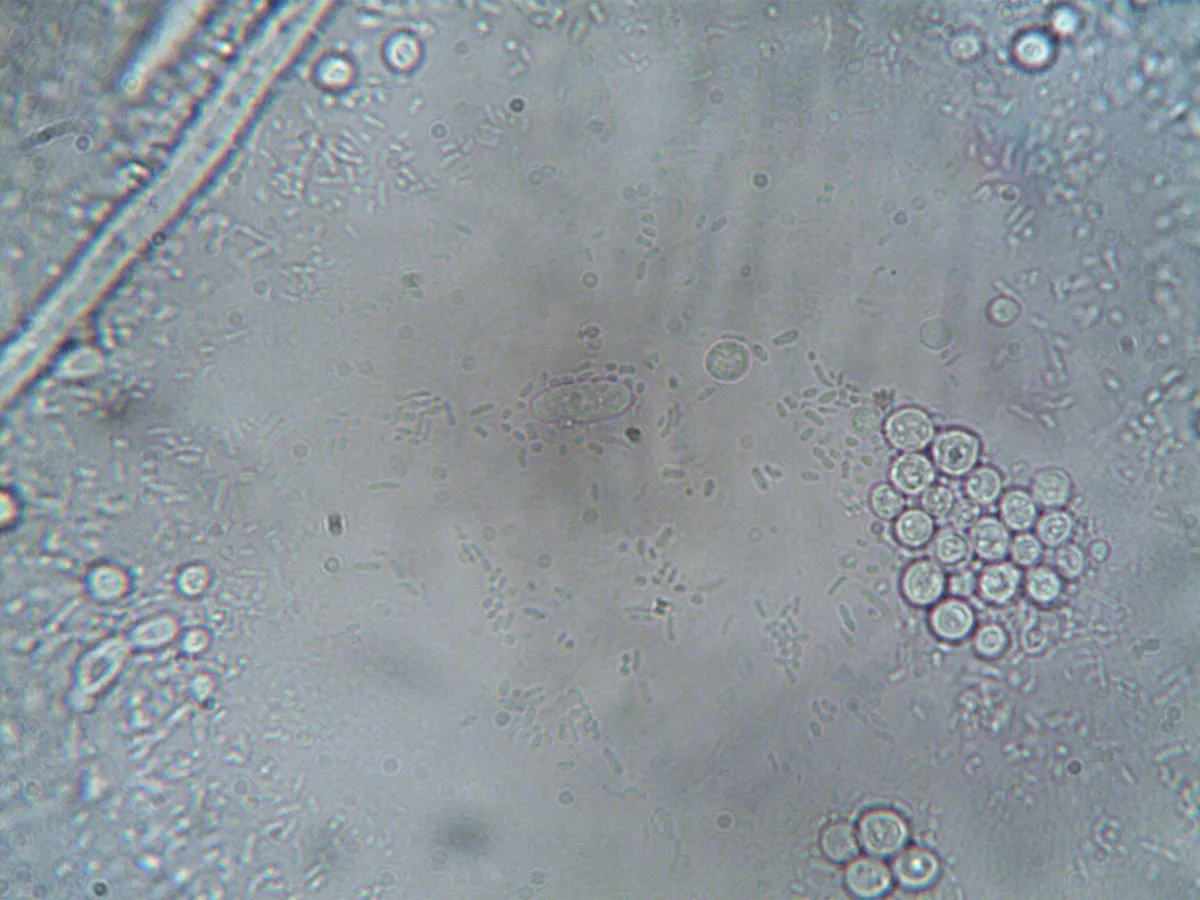 bacteria under microscope