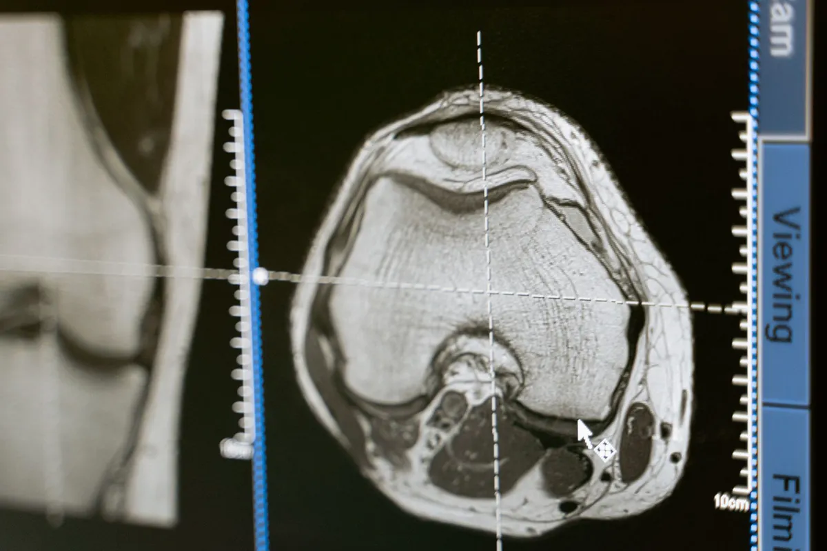 dog MRI scan