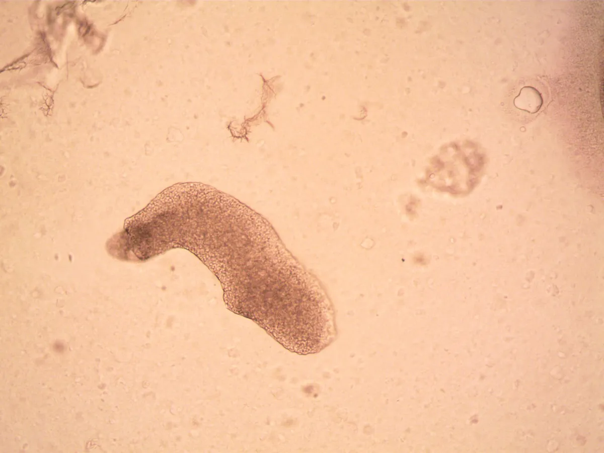 amoeba under microscope